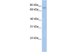 WB Suggested Anti-NSUN2 Antibody Titration:  0. (NSUN2 anticorps  (C-Term))