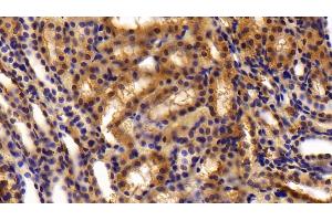 Detection of OLFM4 in Rat Kidney Tissue using Polyclonal Antibody to Olfactomedin 4 (OLFM4)