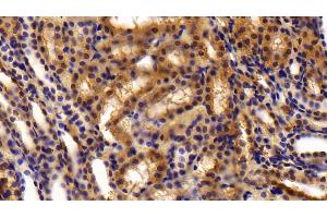 Detection of OLFM4 in Rat Kidney Tissue using Polyclonal Antibody to Olfactomedin 4 (OLFM4) (Olfactomedin 4 anticorps  (AA 405-511))