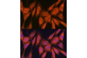 Immunofluorescence analysis of NIH-3T3 cells using Laminin beta 1 Rabbit mAb (ABIN7268185) at dilution of 1:100 (40x lens).