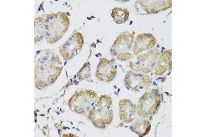 Immunohistochemistry of paraffin-embedded human stomach using USH1C antibody (ABIN5972448) at dilution of 1/100 (40x lens). (USH1C anticorps)
