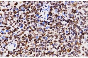 Immunohistochemistry of paraffin-embedded Rat spleen using MonoMethyl-Histone H3-K4 Polyclonal Antibody at dilution of 1:200 (40x lens).