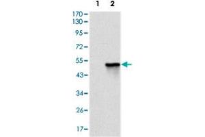 Western blot analysis using TNNI2 monoclonal antobody, clone 2F12G2  against HEK293 (1) and TNNI2 (aa1-182)-hIgGFc transfected HEK293 (2) cell lysate. (TNNI2 anticorps)