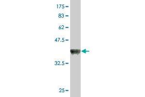 Western Blot detection against Immunogen (37.