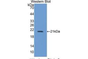 WB of Protein Standard: different control antibodies against Highly purified E.