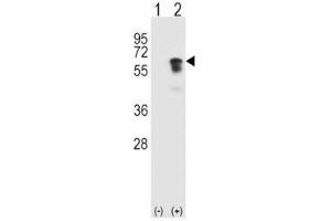 Western blot analysis of ALK2 antibody and 293 cell lysate (2 ug/lane) either nontransfected (Lane 1) or transiently transfected (2) with the ACVR1 gene. (ACVR1 anticorps  (AA 132-162))