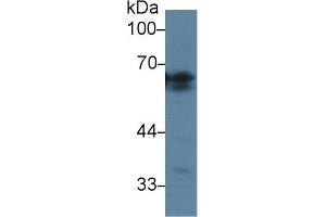 Detection of AGT in Rat Kidney lysate using Polyclonal Antibody to Angiotensinogen (AGT)