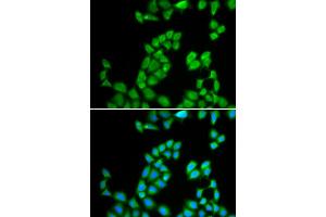 Immunofluorescence analysis of MCF-7 cells using RNASE13 antibody. (RNASE13 anticorps)