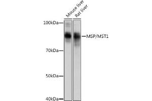 Western blot analysis of extracts of various cell lines, using MSP/MST1 Rabbit mAb (ABIN1680891, ABIN1680890, ABIN3015057 and ABIN3015058) at 1:1000 dilution.