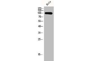 Western Blot analysis of Hela cells using GCN5 Polyclonal Antibody