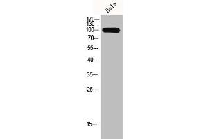 Western Blot analysis of Hela cells using GCN5 Polyclonal Antibody (KAT2A anticorps  (C-Term))