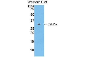Western blot analysis of the recombinant protein. (IFNAR1 anticorps  (AA 244-512))
