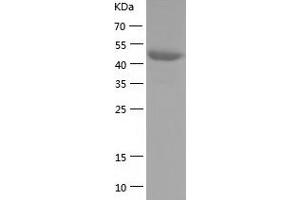 Western Blotting (WB) image for SMAD, Mothers Against DPP Homolog 2 (SMAD2) (AA 2-467) protein (His-IF2DI Tag) (ABIN7125122)