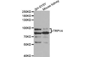 Western blot analysis of extracts of various cell lines, using TRPV4 antibody (ABIN5973304) at 1/1000 dilution. (TRPV4 anticorps)