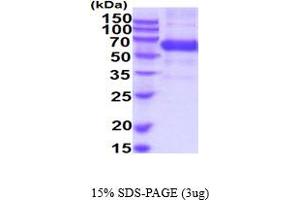 SDS-PAGE (SDS) image for Biotinidase (BTD) (AA 44-545) protein (His tag) (ABIN6387911) (BTD Protein (AA 44-545) (His tag))