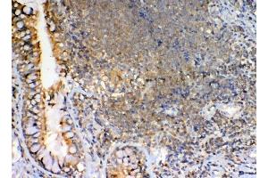IHC analysis of GRK2 using anti-GRK2 antibody (ABIN5693069).