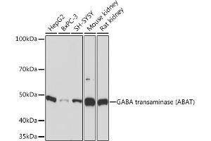 Western blot analysis of extracts of various cell lines, using GABA transaminase (GABA transaminase (ABAT)) Rabbit mAb (ABIN7265336) at 1:1000 dilution. (ABAT anticorps)