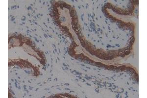 IHC-P analysis of Mouse Vas Deferens Tissue, with DAB staining. (Thymic Stromal Lymphopoietin anticorps  (AA 21-138))