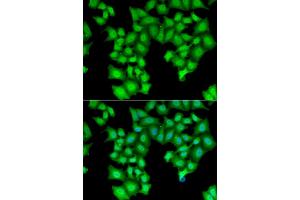 Immunofluorescence analysis of HeLa cell using CPSF3L antibody.