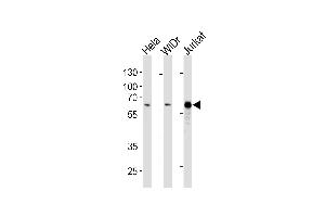 HDAC1 Antibody (ABIN1882195 and ABIN2843403) western blot analysis in Hela,WiDr,Jurkat cell line lysates (35 μg/lane). (HDAC1 anticorps)
