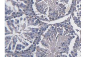 DAB staining on IHC-P; Samples: Mouse Testis Tissue (FKBPL anticorps  (AA 1-347))