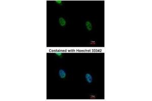 ICC/IF Image Immunofluorescence analysis of paraformaldehyde-fixed HeLa, using hnRNP K, antibody at 1:500 dilution.