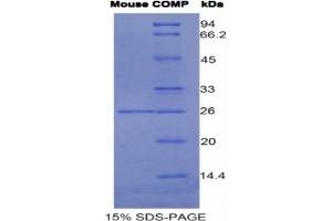 SDS-PAGE of Protein Standard from the Kit (Highly purified E. (COMP Kit ELISA)