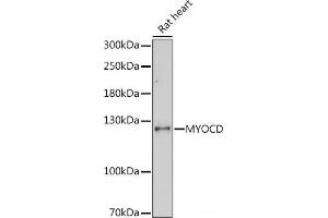 Western blot analysis of extracts of Rat heart using MYOCD Polyclonal Antibody at dilution of 1:1000. (Myocardin anticorps)