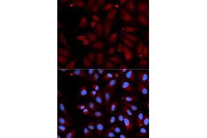 Immunofluorescence analysis of U2OS cell using MAOB antibody. (Monoamine Oxidase B anticorps)