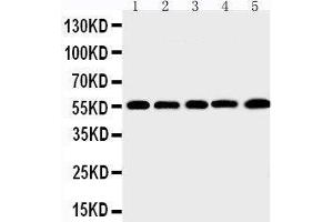 Anti-MMP12 antibody, Western blotting Lane 1: SMMC Cell Lysate Lane 2: HEPA Cell Lysate Lane 3: HELA Cell Lysate Lane 4: K562 Cell Lysate Lane 5: MCF-7 Cell Lysate (MMP12 anticorps  (C-Term))