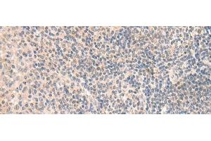 Immunohistochemistry of paraffin-embedded Human tonsil tissue using GRM2 Polyclonal Antibody at dilution of 1:50(x200) (GRM2 anticorps)