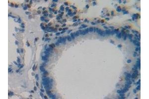 Detection of P53 in Mouse Lung Tissue using Polyclonal Antibody to Tumor Protein p53 (P53)