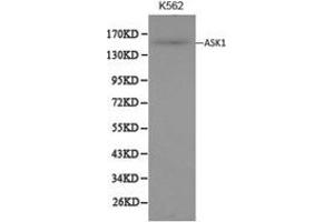 Western Blotting (WB) image for anti-Mitogen-Activated Protein Kinase Kinase Kinase 5 (MAP3K5) antibody (ABIN1873617) (ASK1 anticorps)