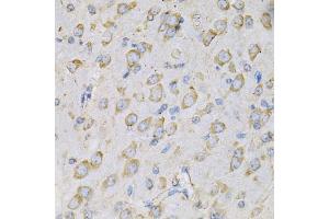 Immunohistochemistry of paraffin-embedded rat brain using IL10RA Antibody (ABIN3022614, ABIN3022615, ABIN3022616, ABIN1513078 and ABIN6218954) at dilution of 1:100 (40x lens). (IL-10RA anticorps  (AA 22-230))