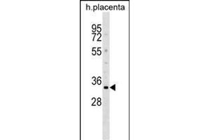 DOK5 Antibody (N-term) (ABIN1539174 and ABIN2848803) western blot analysis in human placenta tissue lysates (35 μg/lane).