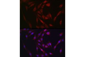 Immunofluorescence analysis of NIH/3T3 cells using FGF23 antibody (ABIN6127894, ABIN6140600, ABIN6140602 and ABIN6221721) at dilution of 1:25. (FGF23 anticorps  (AA 25-251))