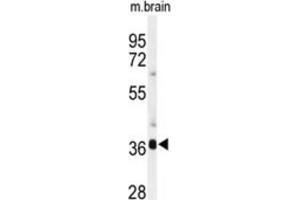 Western Blotting (WB) image for anti-Sirtuin 3 (SIRT3) antibody (ABIN2911469) (SIRT3 anticorps)