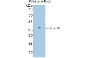 Western blot analysis of the recombinant protein. (HLA-E anticorps  (AA 136-350))