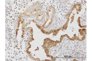 Immunoperoxidase of monoclonal antibody to ANXA4 on formalin-fixed paraffin-embedded human endometrium.