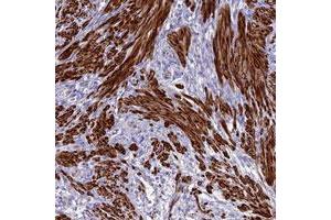 Immunohistochemical staining of human smooth muscle with CLIP4 polyclonal antibody  shows strong cytoplasmic positivity in smooth muscle cells at 1:20-1:50 dilution.
