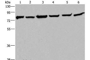 Western Blot analysis of Mouse kidney tissue, HT-29, A549, 293T, MCF-7 and Hela cell using HSPA9 Polyclonal Antibody at dilution of 1:400 (HSPA9 anticorps)