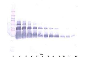 Image no. 1 for anti-Vascular Endothelial Growth Factor A (VEGFA) antibody (Biotin) (ABIN465275) (VEGFA anticorps  (Biotin))