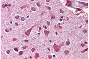 Human Brain, Cortex (formalin-fixed, paraffin-embedded) stained with MCL1 antibody ABIN214512 at 2 ug/ml followed by biotinylated goat anti-rabbit IgG secondary antibody ABIN481713, alkaline phosphatase-streptavidin and chromogen. (MCL-1 anticorps  (C-Term))