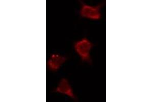 ABIN6274036 staining Hela by IF/ICC. (PIK3R2 anticorps  (C-Term))