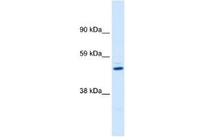 KCNAB1 antibody used at 1 ug/ml to detect target protein. (KCNAB1 anticorps  (C-Term))