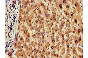 Immunohistochemistry of paraffin-embedded human liver tissue using ABIN7162155 at dilution of 1:100 (OLFML3 anticorps  (AA 201-406))