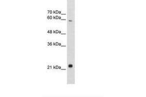 Image no. 1 for anti-Recombination Signal Binding Protein For Immunoglobulin kappa J Region-Like (RBPJL) (AA 110-159) antibody (ABIN203286)