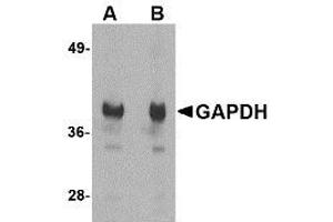 Image no. 1 for anti-Glyceraldehyde-3-Phosphate Dehydrogenase (GAPDH) (N-Term) antibody (ABIN341735) (GAPDH anticorps  (N-Term))
