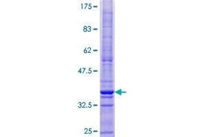 Image no. 1 for CKLF-Like MARVEL Transmembrane Domain Containing 1 (CMTM1) (AA 1-114) protein (GST tag) (ABIN1349786)