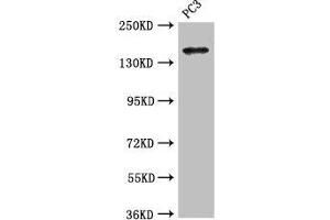Western Blot Positive WB detected in: PC-3 whole cell lysate All lanes: ASTN2 antibody at 3. (Astrotactin 2 anticorps  (AA 108-272))
